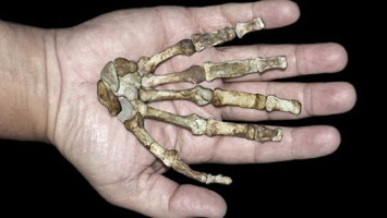 Hand